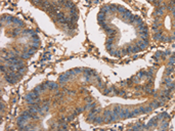 Rabbit Polyclonal Antibody to HK3