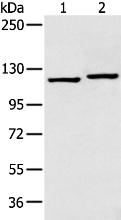 Rabbit Polyclonal Antibody to HK1