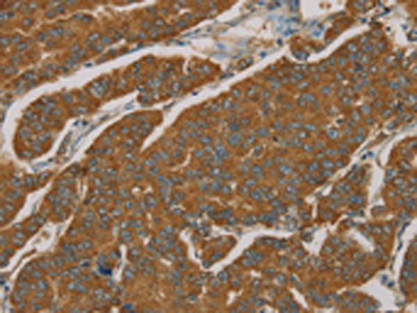 Rabbit Polyclonal Antibody to NPPB