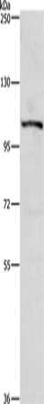 Rabbit Polyclonal Antibody to PTK2