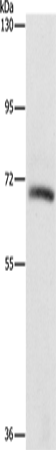 Rabbit Polyclonal Antibody to KLC1