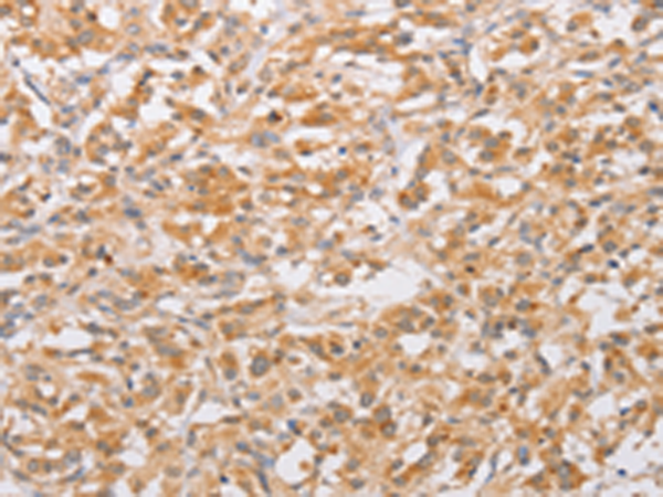 Rabbit Polyclonal Antibody to CSGALNACT2