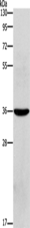 Rabbit Polyclonal Antibody to OLR1