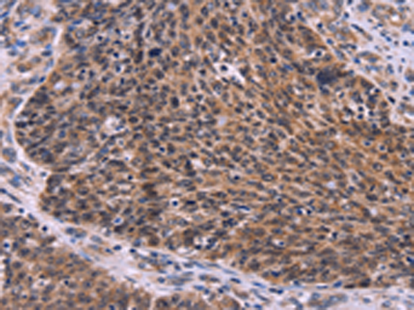 Rabbit Polyclonal Antibody to CDC5L