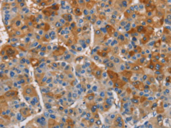 Rabbit Polyclonal Antibody to CST4