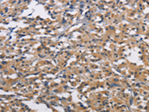 Rabbit Polyclonal Antibody to CBY1