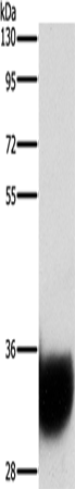 Rabbit Polyclonal Antibody to GPM6A