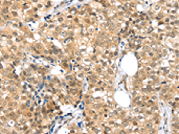 Rabbit Polyclonal Antibody to TPR