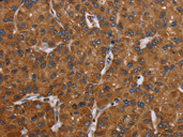 Rabbit Polyclonal Antibody to C12orf75