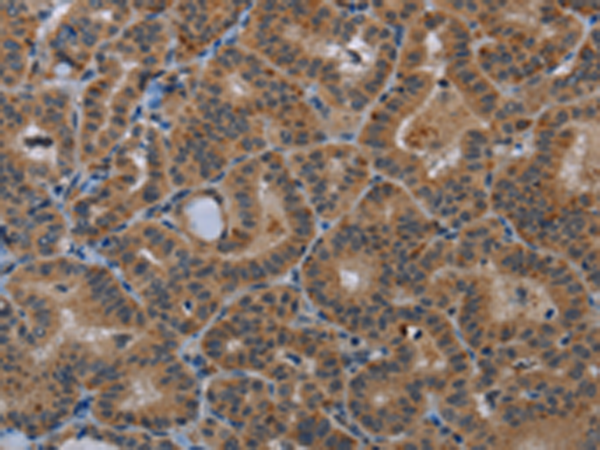 Rabbit Polyclonal Antibody to SLC22A2