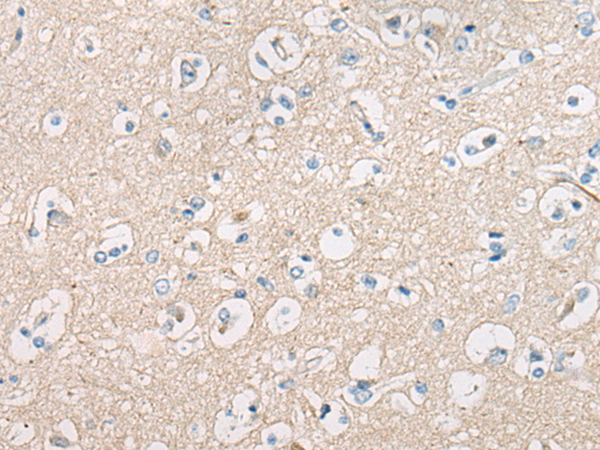 Rabbit Polyclonal Antibody to LTO1