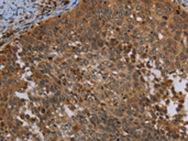 Rabbit Polyclonal Antibody to OSM