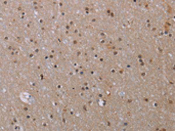 Rabbit Polyclonal Antibody to MED12