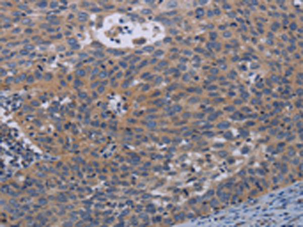 Rabbit Polyclonal Antibody to PAPPA