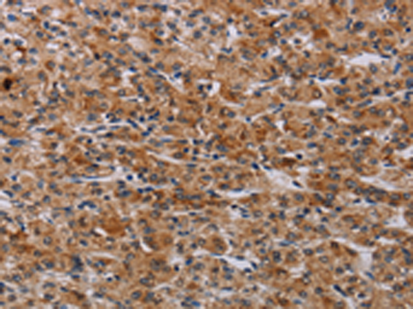 Rabbit Polyclonal Antibody to F2RL2