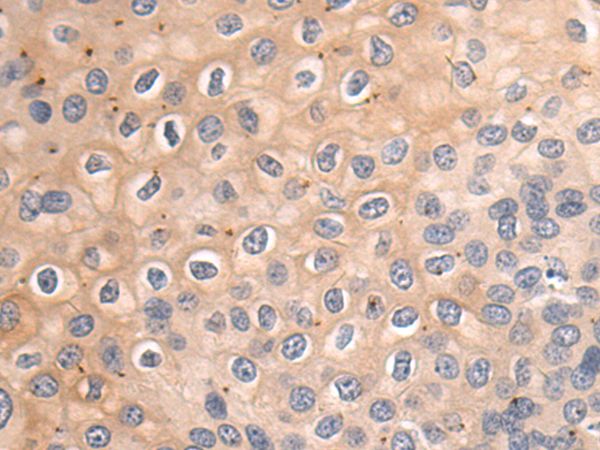 Rabbit Polyclonal Antibody to PARP4