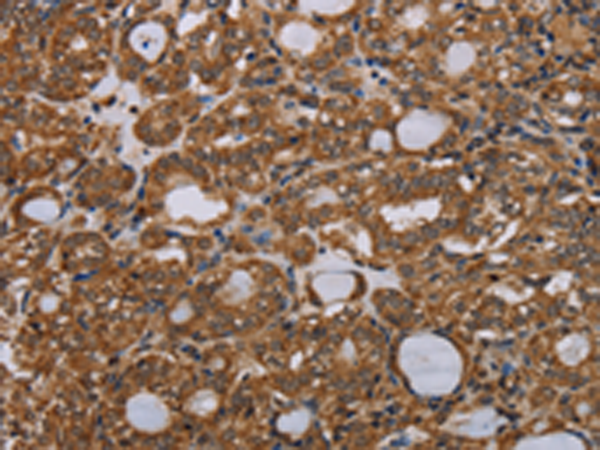 Rabbit Polyclonal Antibody to PARP8