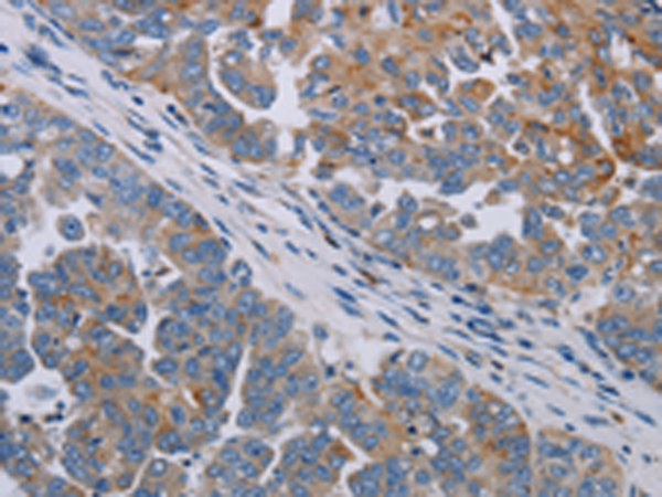Rabbit Polyclonal Antibody to PARP10