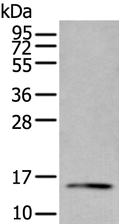 Rabbit Polyclonal Antibody to PBOV1