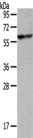 Rabbit Polyclonal Antibody to IVL