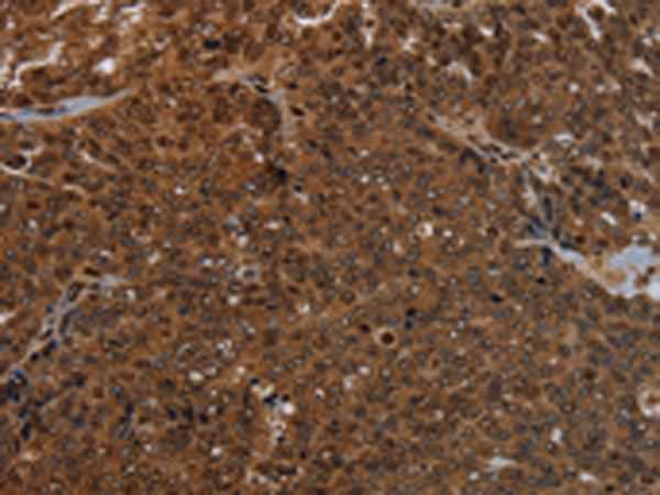Rabbit Polyclonal Antibody to KDM4B