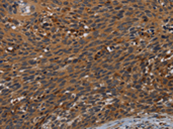 Rabbit Polyclonal Antibody to PCDHB15