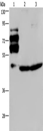 Rabbit Polyclonal Antibody to PCSK9