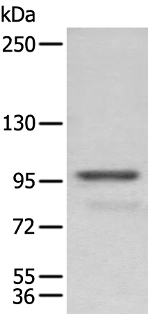 Rabbit Polyclonal Antibody to PDCD6IP