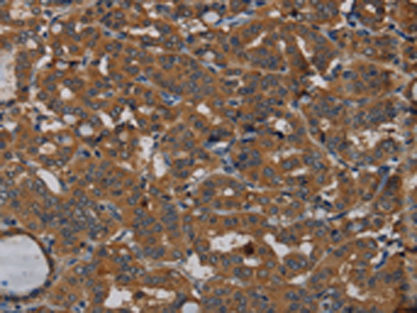 Rabbit Polyclonal Antibody to PDE5A