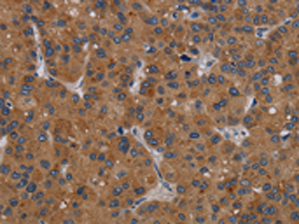 Rabbit Polyclonal Antibody to PDGFC