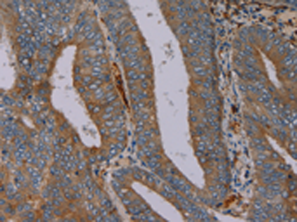 Rabbit Polyclonal Antibody to PYY