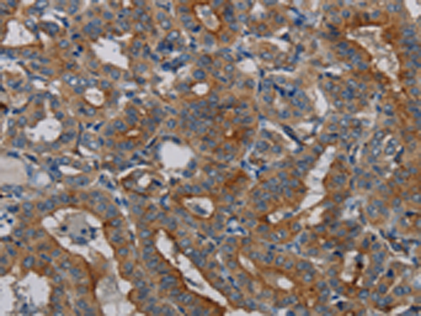 Rabbit Polyclonal Antibody to PER2