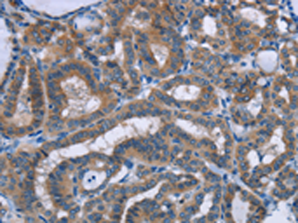 Rabbit Polyclonal Antibody to PLIN1