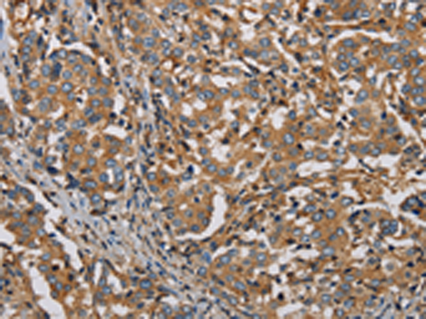 Rabbit Polyclonal Antibody to PLIN3