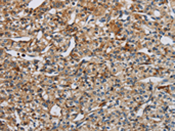 Rabbit Polyclonal Antibody to EIF2AK3
