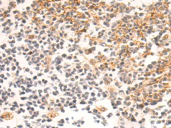 Rabbit Polyclonal Antibody to HSPG2