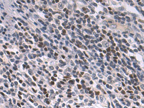 Rabbit Polyclonal Antibody to PPARGC1A