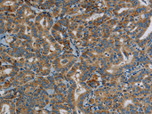 Rabbit Polyclonal Antibody to PPARGC1B