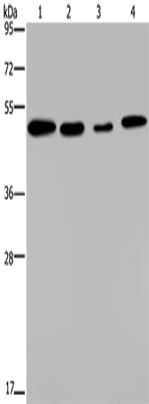 Rabbit Polyclonal Antibody to PHKG2