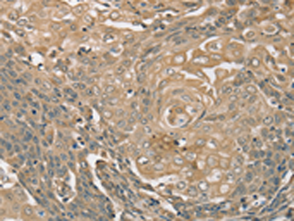 Rabbit Polyclonal Antibody to PIK3CD