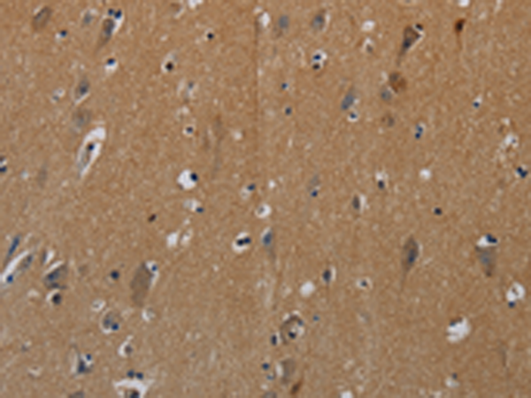 Rabbit Polyclonal Antibody to PIK3CG