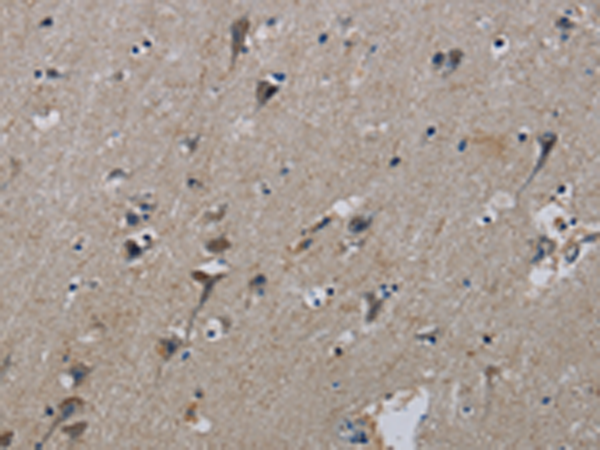 Rabbit Polyclonal Antibody to PIK3CB