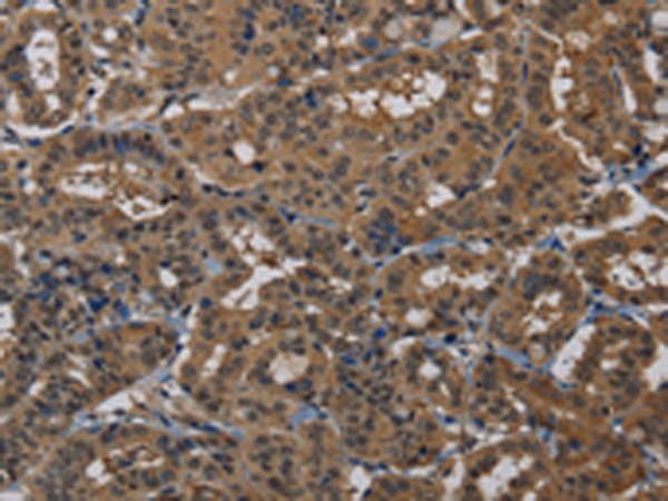 Rabbit Polyclonal Antibody to PNN