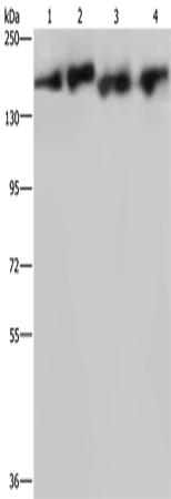 Rabbit Polyclonal Antibody to PLCB3