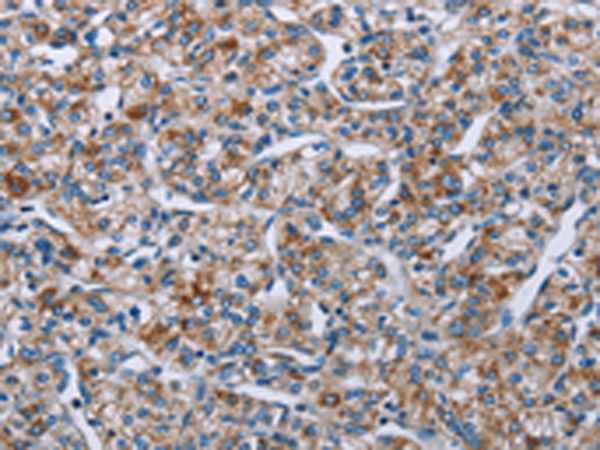 Rabbit Polyclonal Antibody to PLCL1
