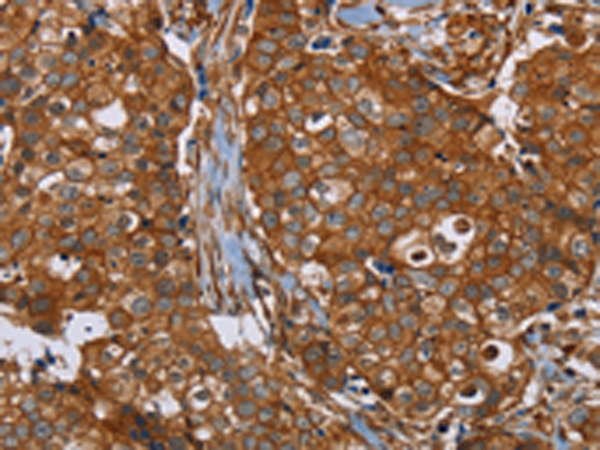 Rabbit Polyclonal Antibody to PLEC