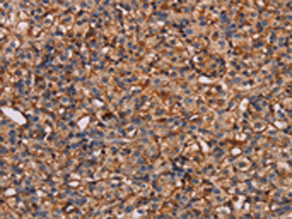 Rabbit Polyclonal Antibody to PLXNA1