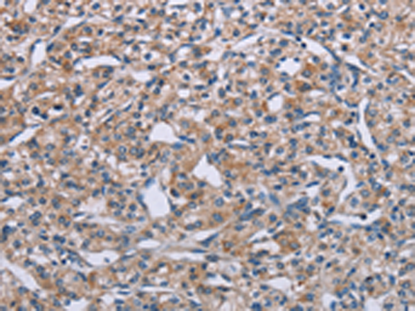 Rabbit Polyclonal Antibody to PLXNA2