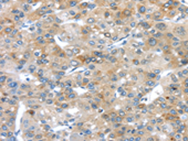 Rabbit Polyclonal Antibody to PLXNA3