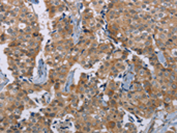 Rabbit Polyclonal Antibody to PLXNA4